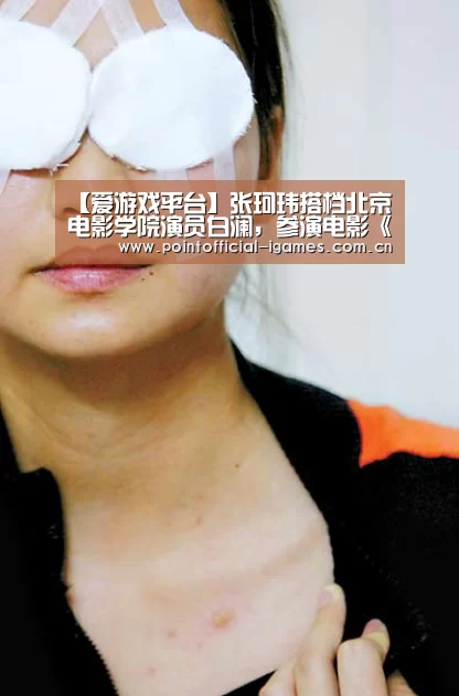 爱游戏APP